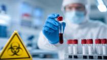 Ebola Şüphesiyle Hastaneye Kaldırılan Genç Kadın Hakkında Sonuç Belli Oldu